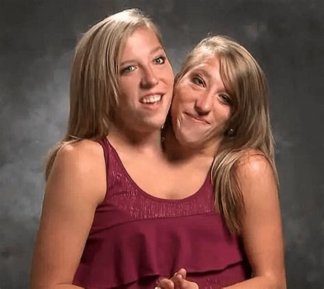 conjoined twins porn